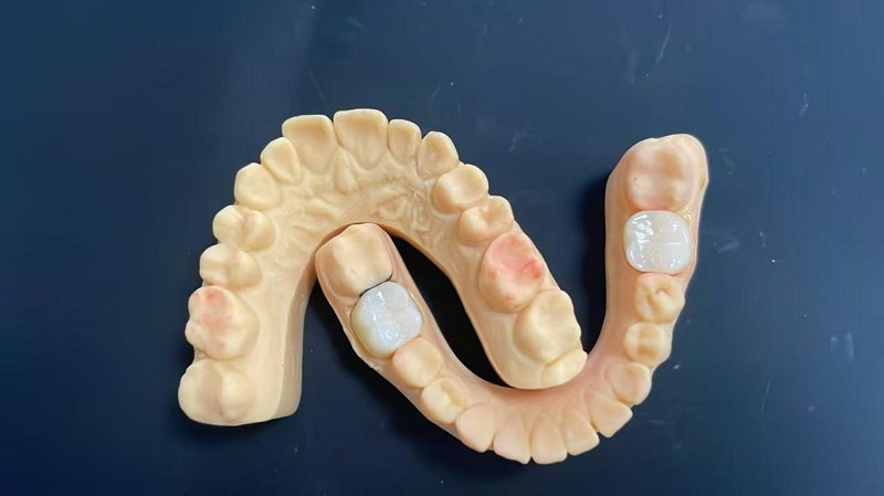 Kas yra peties kraštas?