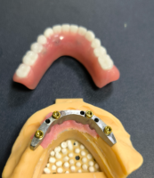 Lokatorius ir dantų baras